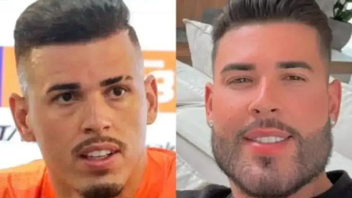 Henri Castelli faz nova harmonização facial e mostra resultado; veja