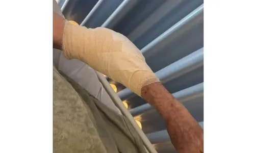 Idoso é atacado por pitbull e leva mais de 20 pontos no braço