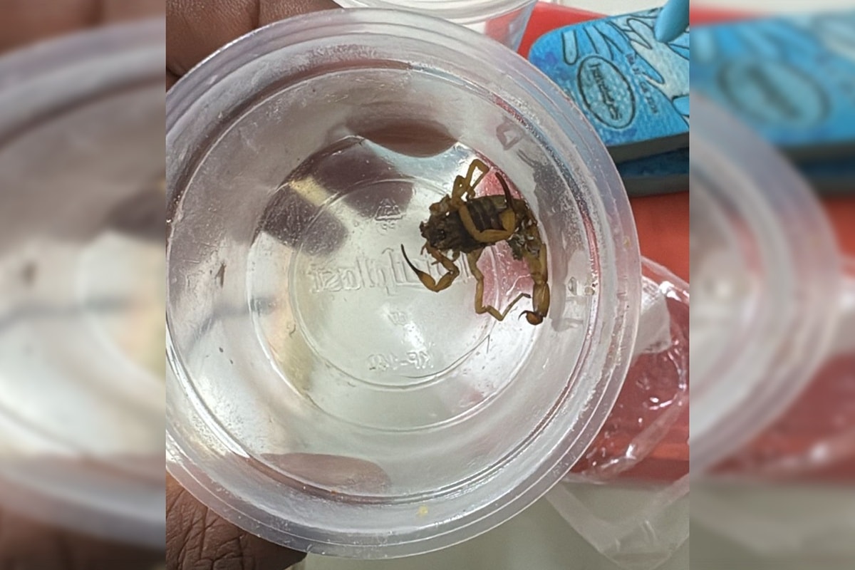 Criança internada após ser picada por escorpião no Guará recebe alta