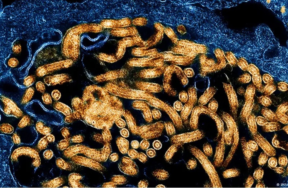 Ebola: Secretaria da Saúde de SP reforça vigilância no estado