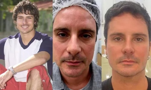 Lembra dele? Ex-Galã de Malhação faz mudança radical no rosto aos 51 anos e resultado surpreende; veja antes e depois