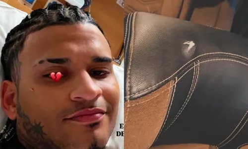 Anderson Neiff expõe imagens da van logo após ataque a tiros; VÍDEO