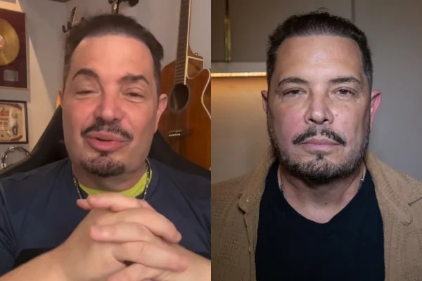 Conrado faz harmonização facial e muda o visual; veja o antes e depois