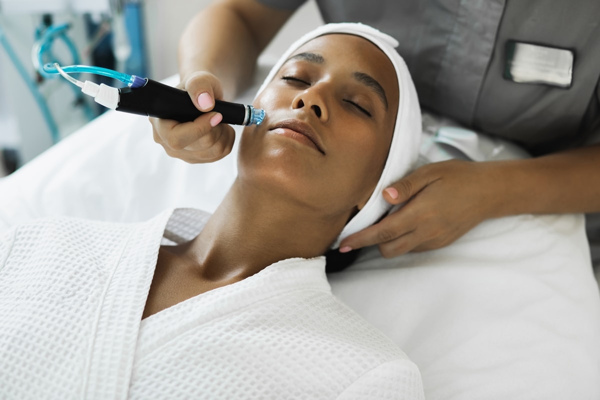 Depilação a laser facial elimina pelos indesejados de forma segura