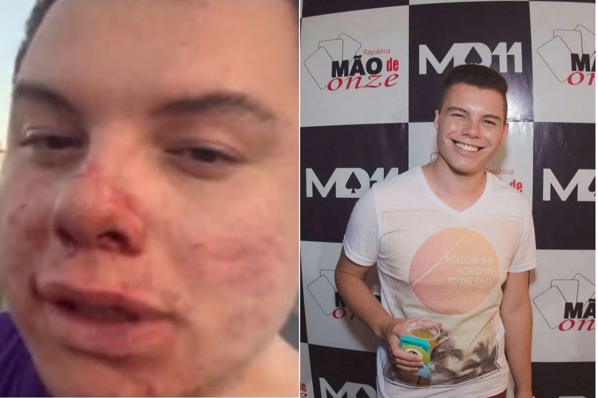 "Economíadas": jovem é internado após agressão em festa universitária