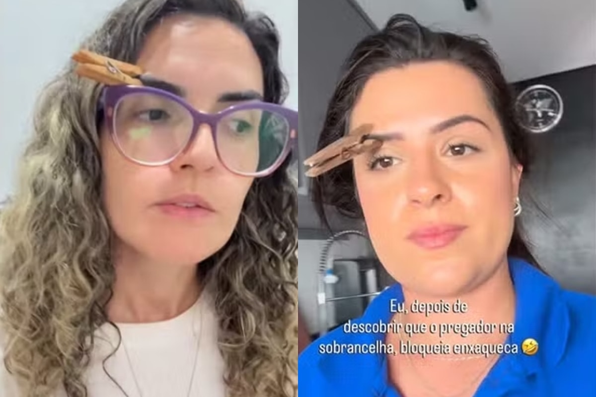 Pregador na sobrancelha alivia enxaqueca? Médica avalia truque viral